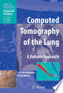 Computed Tomography of the Lung [E-Book] : A Pattern Approach /