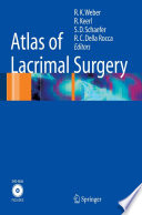 Atlas of Lacrimal Surgery [E-Book] /