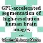 GPU-accelerated segmentation of high-resolution human brain images acquired with polarized light imaging [E-Book] /
