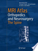 MRI Atlas Orthopedics and Neurosurgery The Spine [E-Book] /