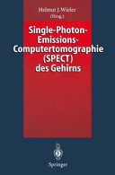 Single Photon Emissions Computertomographie (SPECT) des Gehirns.