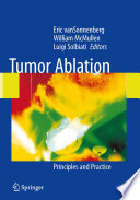 Tumor Ablation [E-Book] : Principles and Practice /